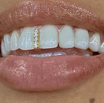 ✨ Gleam Vertical Bar Grillz ✨