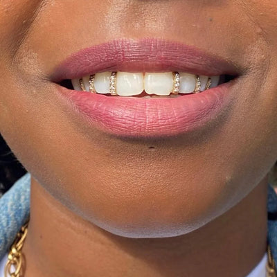 ✨ Gleam Vertical Bar Grillz ✨