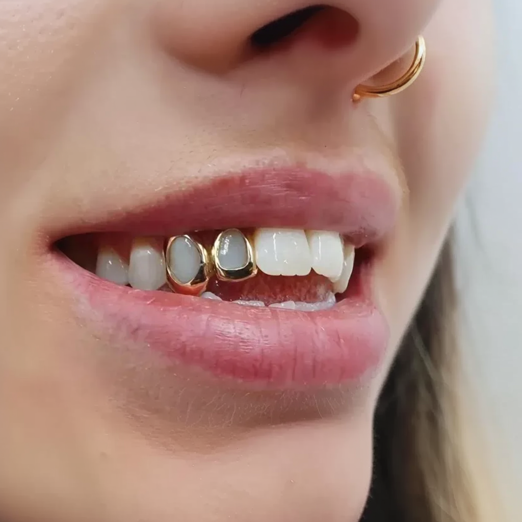 Gold-Plated Hollow Tooth Grillz – A Minimalist Statement